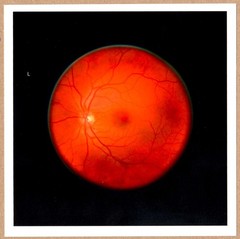 SIGNED MIKHAEL SUBOTZKY RETINAL SELF-PORTRAIT LEFT EYE LTD 6 x 6 MAGNUM PRINT