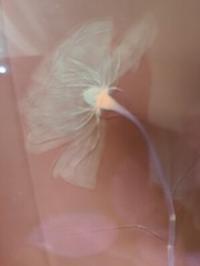 Medical Photography X Ray Old A Rose Alain Pol Kodak 73