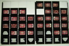 Dentist Dental Technology Braces 91 Special Vintage Slides