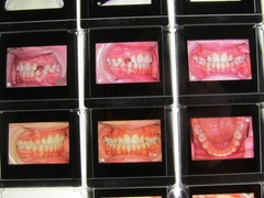 Dentist Dental Technology Braces 91 Special Vintage Slides