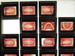 Dentist Dental Technology Braces 91 Special Vintage Slides