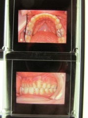 Dentist Dental Technology Braces 91 Special Vintage Slides