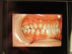 Dentist Dental Technology Braces 91 Special Vintage Slides