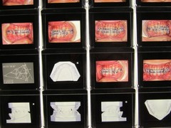 Dentist Dental Technology Braces 91 Special Vintage Slides