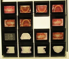 Dentist Dental Technology Braces 91 Special Vintage Slides