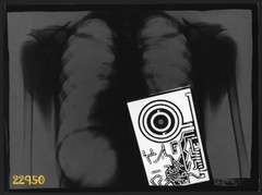 Larger size fine art Photo montage, ANATOMIA 1. by E. Szabó István 1970′ Hungary