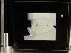 Dentist Dental Technology Braces 91 Special Vintage Slides