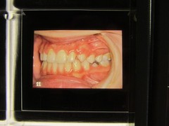 Dentist Dental Technology Braces 91 Special Vintage Slides