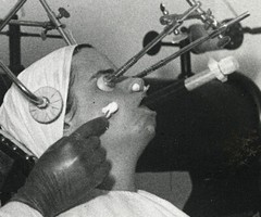 Larger Size Vintage fine art Photograph, freckle removal in hospital, unusual 19