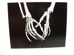 2 Original 2007 Charles Fendrock Skeleton Hands Photograph