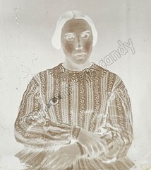 Creepy Woman Ambrotype Photo DIGITAL DOWNLOAD Print at Home Cross Eyed Victorian