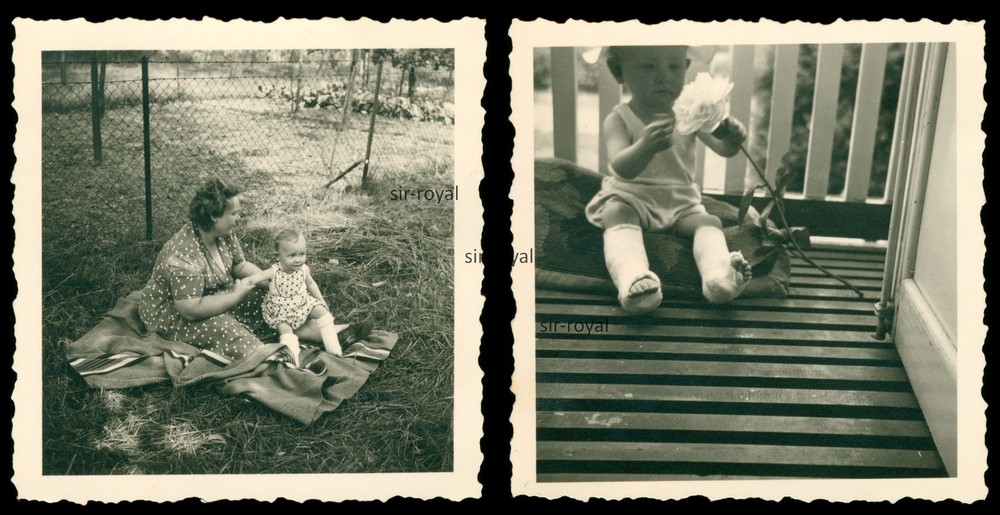 2 x Hamburg around 1954 – Girl with both legs in plaster – 1950s – Photo 6x6cm