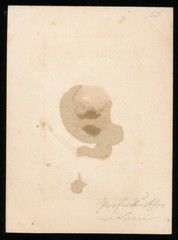 Albumin on Cardboard – View of Laon France – Circa 1870s