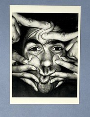 Ehlers-Danlos Syndrome 1989 Art Print Card Photo – David Teplica Fotofolio 4”x6”