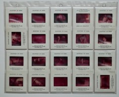 17 NASA Photos Apollo 11, + 20 Slides, Man On The Moon, 1969/Aldrin/Armstrong